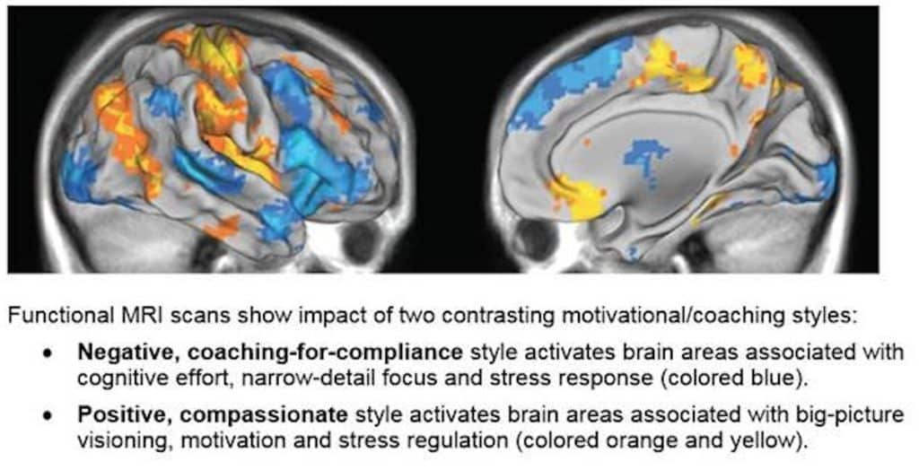 Brain Health 1 Brain scan on motivatonal differences
